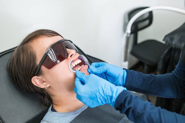 Best Chipped Tooth Repair Near Me  in Burlington, VT
