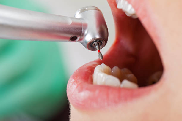 Best Root Canal Emergency Dentist  in Burlington, VT